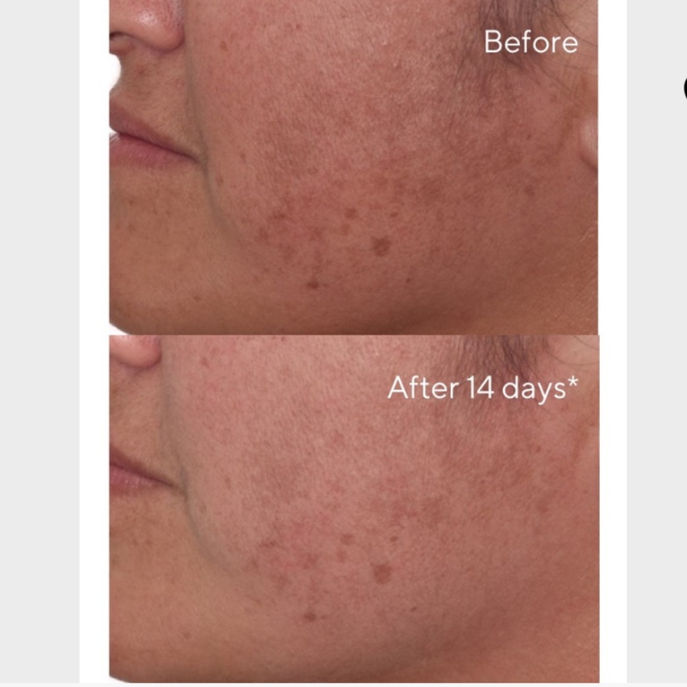 😊 NIB Murad Environmenral Sheild Rapid Dark Spot Correcting Serum 0.17 fl oz 😊 - Picture 3 of 7